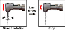 EndoEst Motor-Mini Basic auto stop